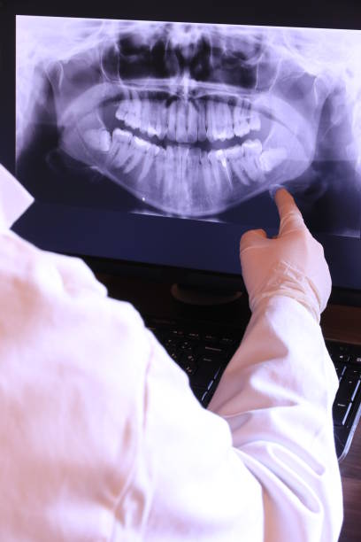 Best Emergency Denture Repair in Eugene, OR