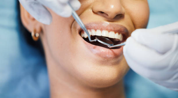Best Emergency Gum Treatment in Eugene, OR